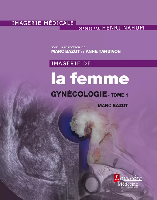 Imagerie de la femme -  - Médecine Sciences Publications