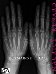 Les Mains d'Orlac