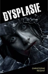 Dysplasie