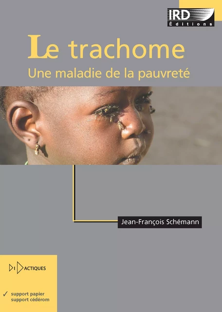 Le trachome - Jean-François Schemann - IRD Éditions