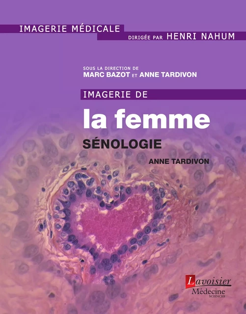 Imagerie de la femme : sénologie - Anne Tardivon - Médecine Sciences Publications