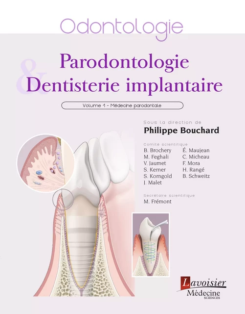 Parodontologie & dentisterie implantaire : Volume 1 : médecine parodontale - Philippe Bouchard - Médecine Sciences Publications