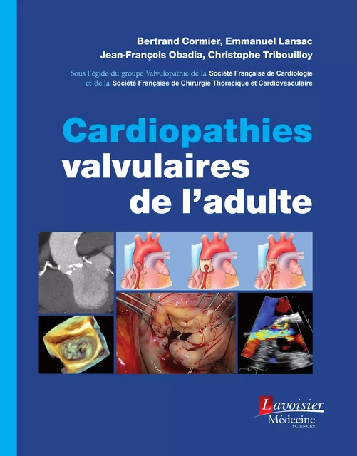 Cardiopathies valvulaires de l'adulte - Bertrand Cormier, Emmanuel Lansac, Jean-François Obadia, Christophe Tribouilloy - Médecine Sciences Publications