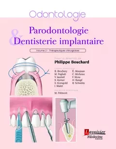 Traité de parodontologie - Volume 2 : aspects chirurgicaux - Philippe Bouchard - Médecine Sciences Publications