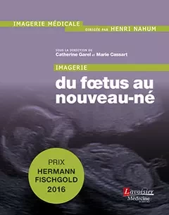 Imagerie : du fœtus au nouveau-né - Catherine Garel, Marie Cassart - Médecine Sciences Publications