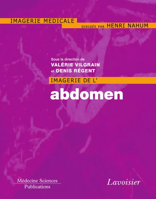 Imagerie de l'abdomen - Valérie Vilgrain - Médecine Sciences Publications