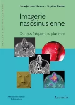 Imagerie nasosinusienne - Jean-Jacques Braun, Sophie Riehm - Médecine Sciences Publications