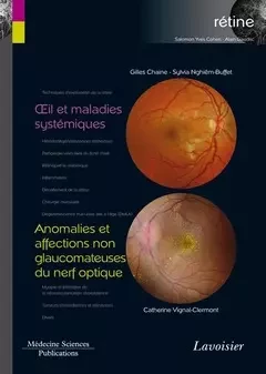 Œil et maladies systémiques / Anomalies et affections non glaucomateuses du nerf optique - Gilles Chaine, Catherine Vignal-Clermont, Sylvia Nghien-Buffet - Médecine Sciences Publications