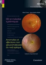 Œil et maladies systémiques / Anomalies et affections non glaucomateuses du nerf optique