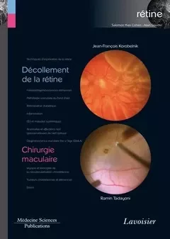 Décollement de la rétine / Chirurgie maculaire - Jean-François Korobelnik, Ramin Tadayoni - Médecine Sciences Publications