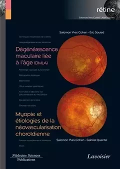 Dégénérescence maculaire liée à l'âge (DMLA) / Myopie et étiologies de la néovascularisation choroïdienne - Salomon-Yves Cohen, Eric Souied, Gabriel Quentel - Médecine Sciences Publications