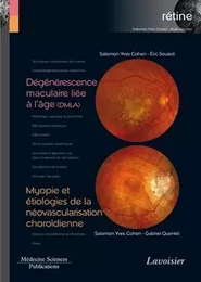 Dégénérescence maculaire liée à l'âge (DMLA) / Myopie et étiologies de la néovascularisation choroïdienne