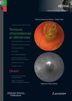 Tumeurs choroïdiennes et rétiniennes / Divers - Salomon-Yves Cohen, Lumbroso-Le Rouic Livia, Sarah Tick - Médecine Sciences Publications