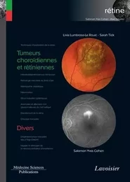 Tumeurs choroïdiennes et rétiniennes / Divers