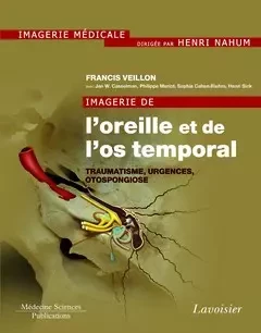 Imagerie de l'oreille et de l'os temporal - Henri Nahum, Francis Veillon, Casselman Jan W. - Médecine Sciences Publications