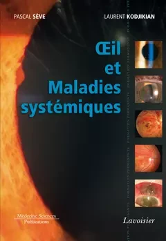 Œil et Maladies systémiques - Pascal Seve, Laurent Kodjikian - Médecine Sciences Publications