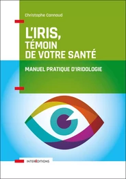 L'iris, témoin de votre santé