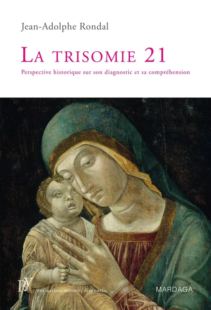 La trisomie 21 - Jean-Adolphe Rondal - Mardaga