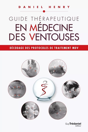 Guide thérapeutique en médecine des ventouses - Décodage des protocoles de traitement MDV. - Daniel Henry - Tredaniel