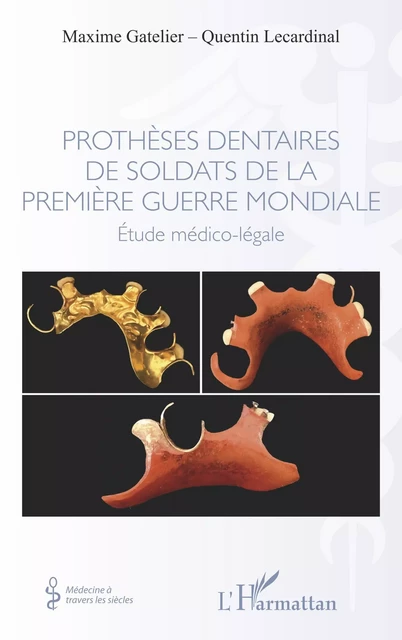 Prothèses dentaires de soldats de la Première Guerre Mondiale - Maxime Gatelier, Quentin Lecardinal - Editions L'Harmattan