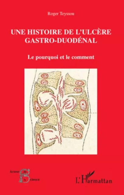 Une histoire de l'ulcère gastro-duodénal - Roger Teyssou - Editions L'Harmattan