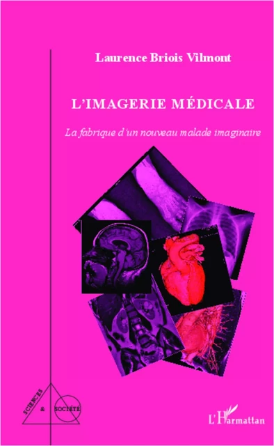 L'imagerie médicale - Laurence Vilmont Briois - Editions L'Harmattan