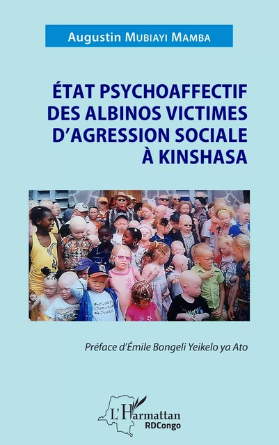 État psychoaffectif des albinos victimes d'agression sociale à Kinshasa - Augustin Mubiayi Mamba - Editions L'Harmattan