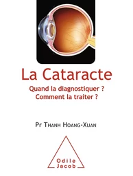 La Cataracte