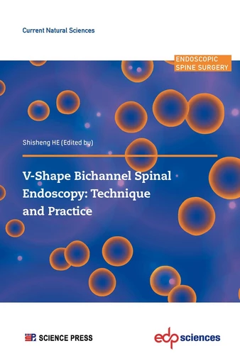 V-shape Bichannel Spinal Endoscopy:  Technique and Practice -  - EDP sciences