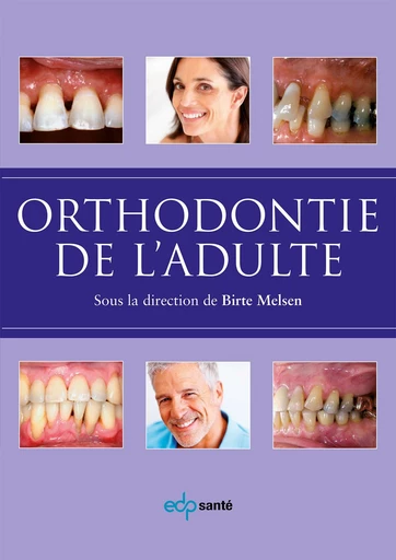 ORTHODONTIE DE L'ADULTE - Birte Melsen - Parresia