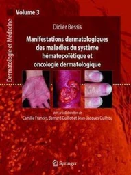 Manifestations dermatologiques des maladies du système hématopoïétiques et oncologie...