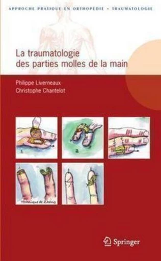 La traumatologie des parties molles de la main - Philippe Liverneaux, Christophe CHANTELOT, Christian FONTAINE, Alain VANNINEUSE - Espaces et signes