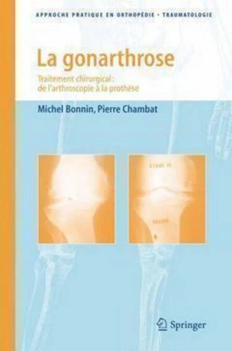 La gonarthrose - Michel Bonnin, Pierre CHAMBAT, Christian FONTAINE, Alain VANNINEUSE - Espaces et signes