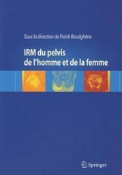 IRM du pelvis de l'homme et de la femme