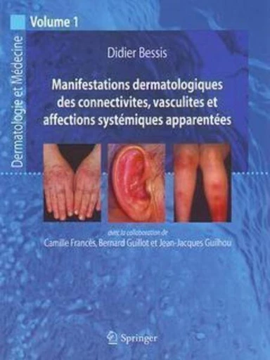 Manifestations dermatologiques des connectivites, vasculites et affections systématiques... - Didier BESSIS,  Collectif - Espaces et signes