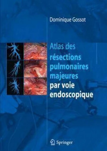 Atlas des résections pulmonaires majeures par voie endoscopique - Dominique GOSSOT - Espaces et signes