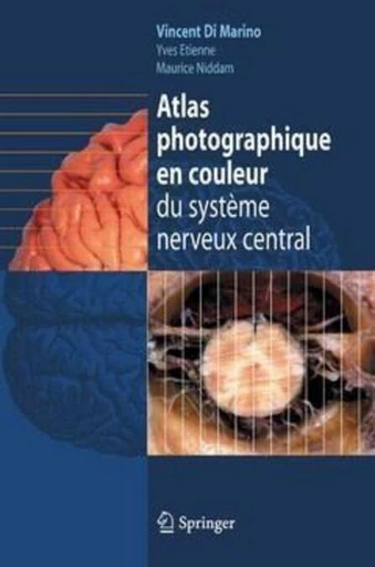 Atlas photographique en couleur du système nerveux central - Vincent DI MARINO, Yves ETIENNE, Maurice NIDDAM - Espaces et signes