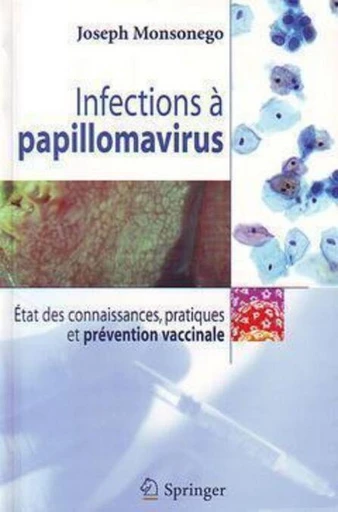 Infections à papillomavirus - Joseph Monsonego - Espaces et signes