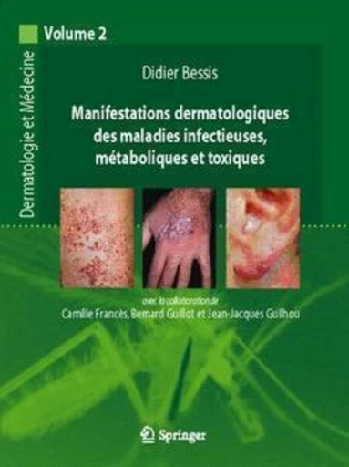 Manifestations dermatologiques des maladies infectieuses, métaboliques et toxiques... - Didier BESSIS,  Collectif - Espaces et signes